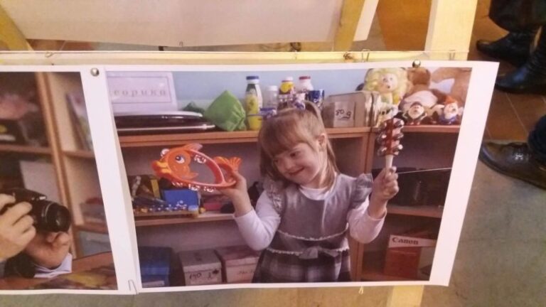 Вони такі ж, як і звичайні діти: у Франківську представили фотовиставку про “дітей сонця” (ФОТО)