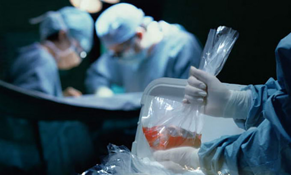В Україні затвердили вартість трансплантації органів