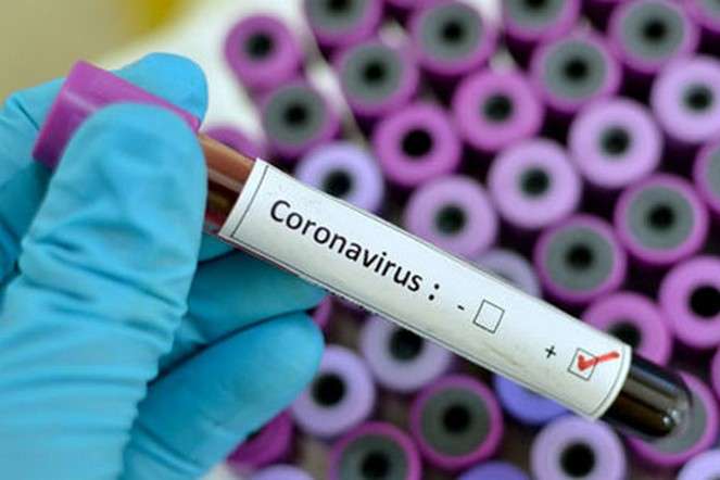 “На Франківщині немає випадків захворювання на коронавірус”, – Ірина Кобельська
