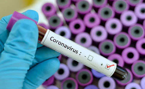 Стало відомо, жителі яких районів області мають коронавірус