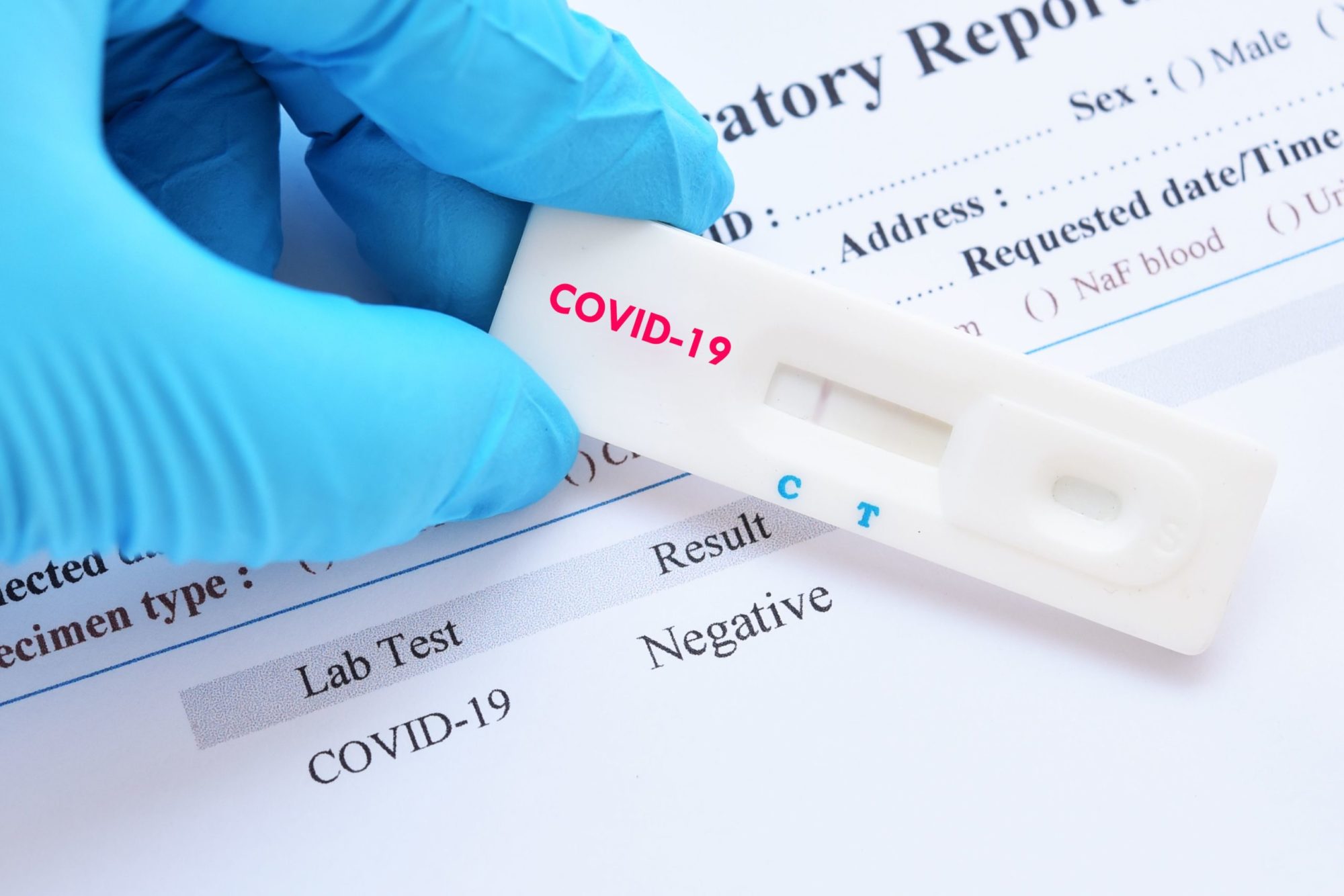 В аптеках області можуть з’явитися експрестести на COVID-19