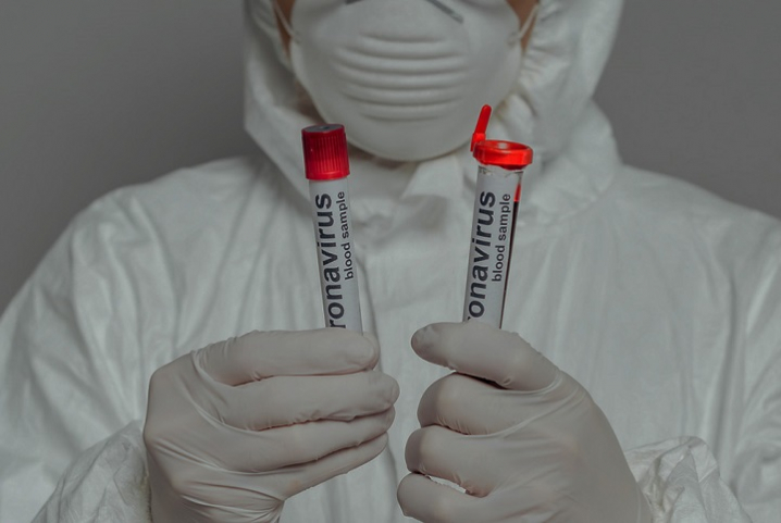 На Прикарпатті за добу підтвердили лише 3 випадки коронавірусу: 12 осіб одужали, одна смерть