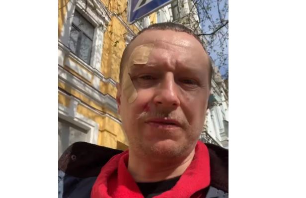 У Києві побили ведучого “Телебачення Торонто” Майкла Щура (ВІДЕО)