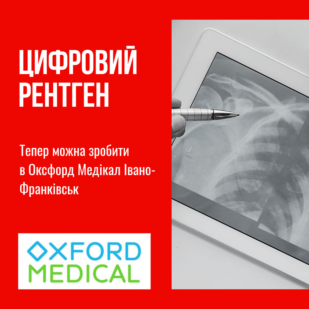 Безпечний та інформативний рентген – апарат останнього покоління в Оксфорд Медікал!