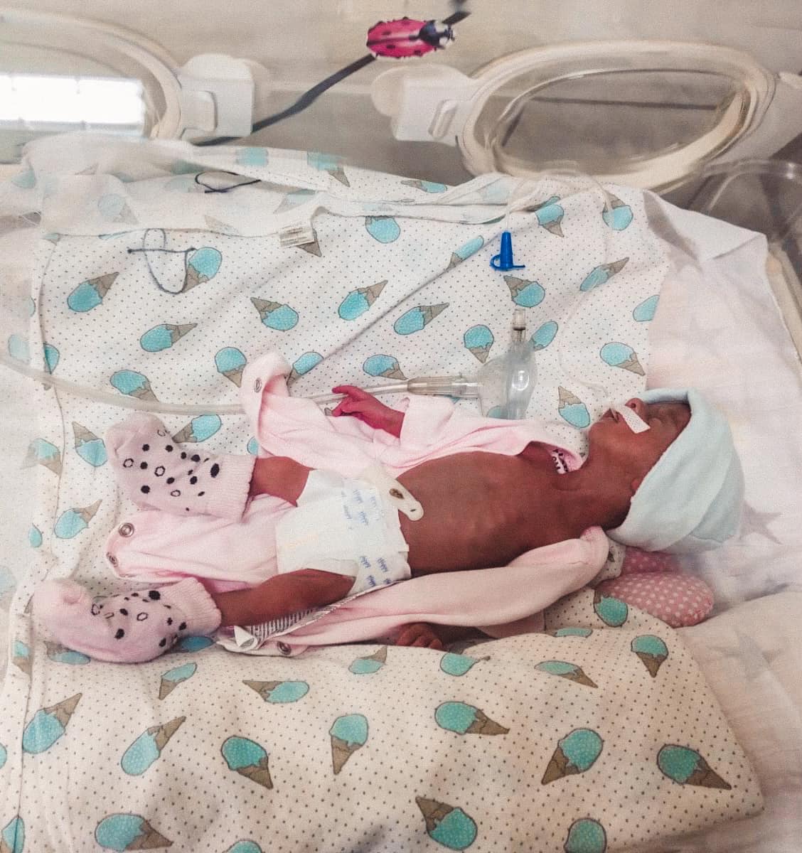 У Рогатині медики врятували немовля з вагою 775 грамів (ФОТО)
