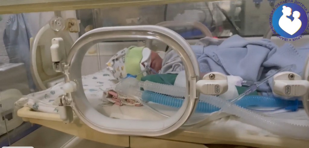 В обласній дитячій лікарні врятували зір передчасно народженому хлопчику (ВІДЕО)