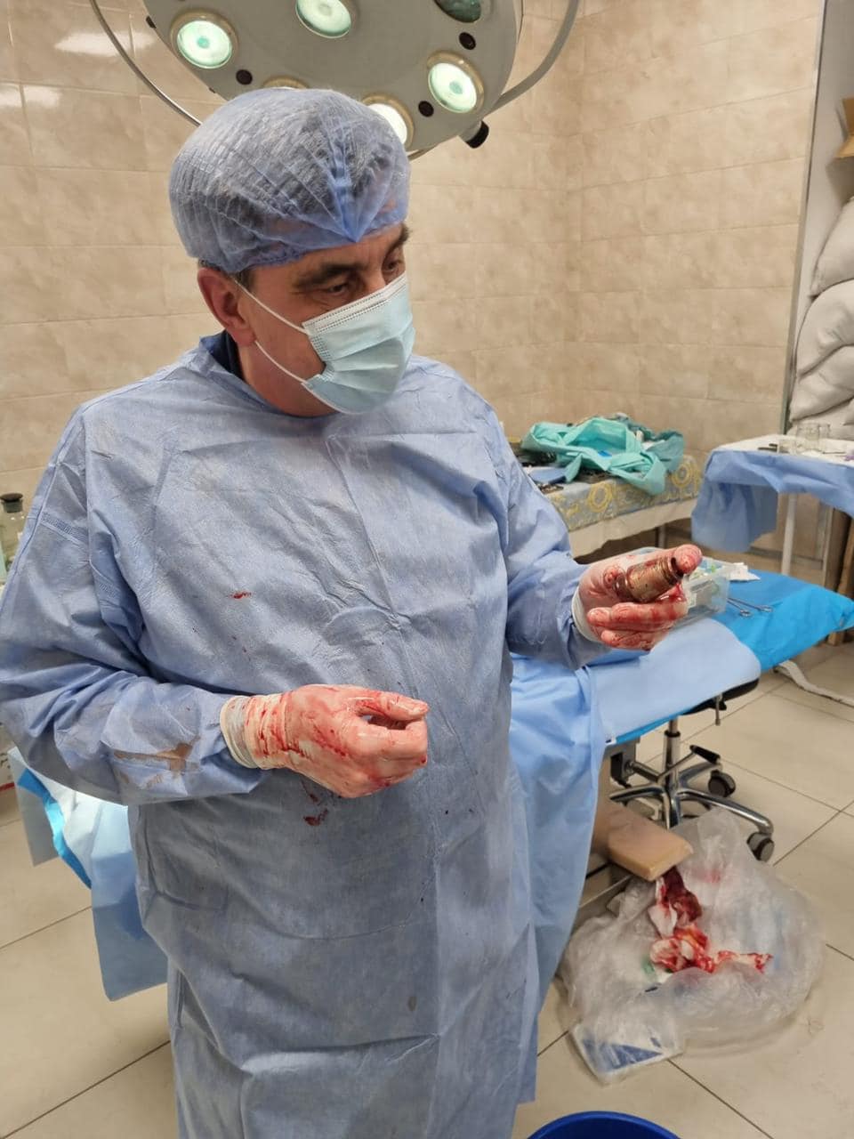 Лікарі видалили з тіла бійця ЗСУ нерозірвану гранату (ФОТОФАКТ)