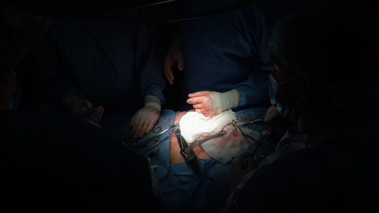 У Франківській обласній лікарні пересадили нирку від посмертного донора (ФОТО)