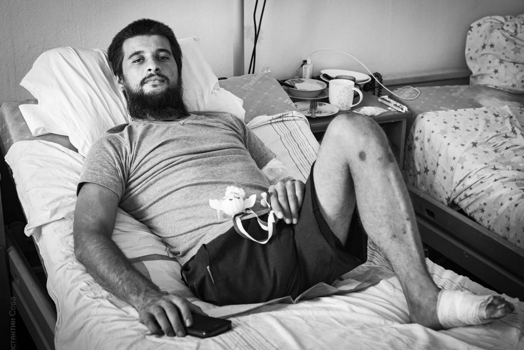 У Франківську лікують Ярослава Худайбергенова — казаха, який втратив ногу, захищаючи Україну (ФОТОФАКТ)