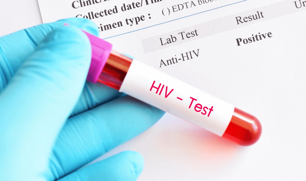 Галка рекомендує: де на Прикарпатті безплатно пройти тест на ВІЛ