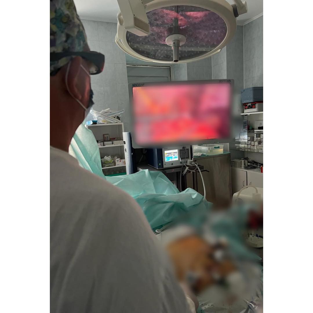 На Прикарпатті онкохірурги вперше видалили рідкісний утвір підшлункової залози – пухлину Франца