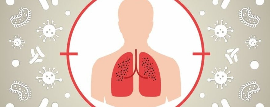 Як пацієнтам з туберкульозом отримати безоплатно медичну допомогу на Франківщині: роз’яснення НСЗУ