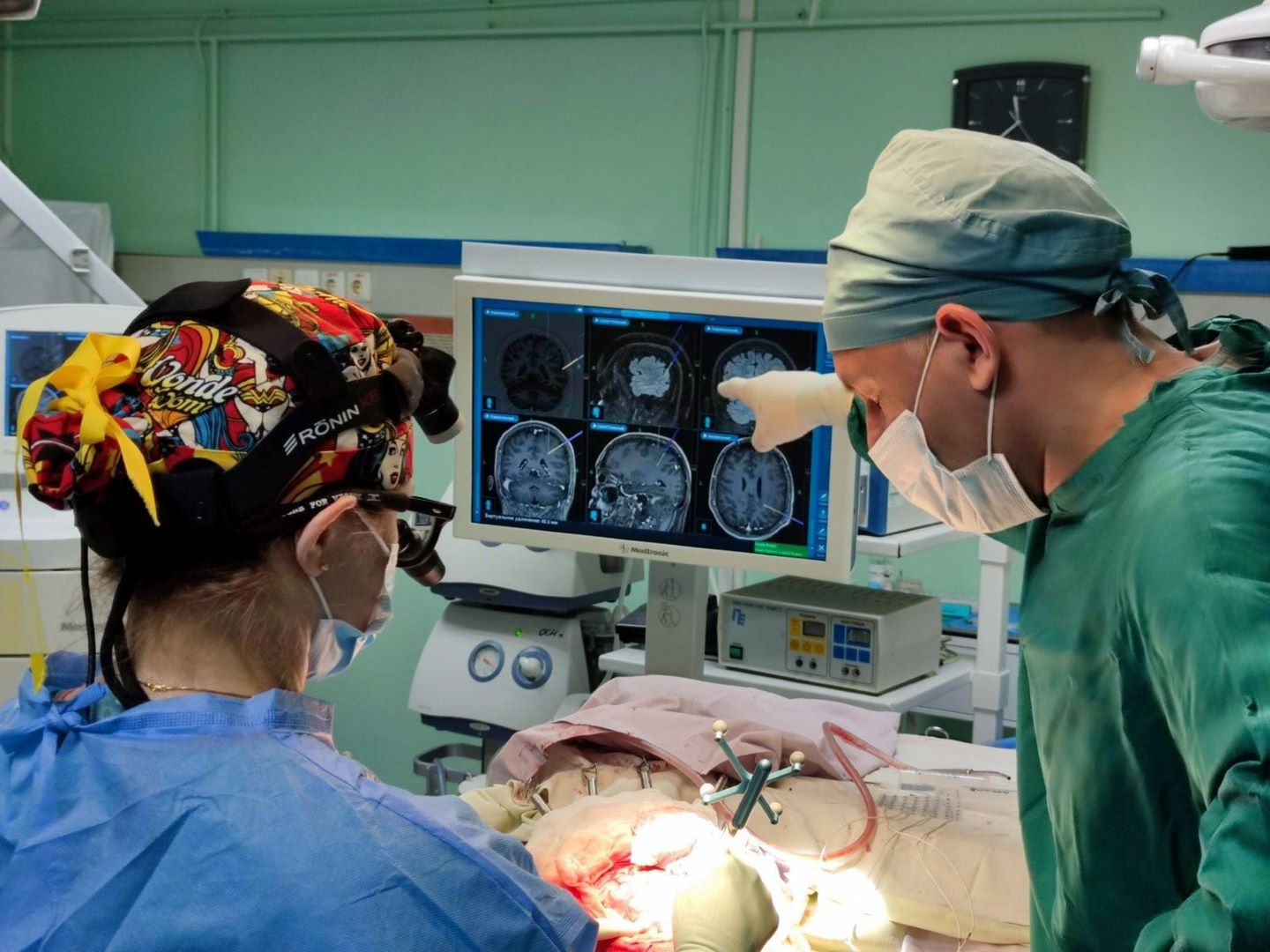 Напади припинилися: у Франківську вперше провели операцію на головному мозку при важкій епілепсії