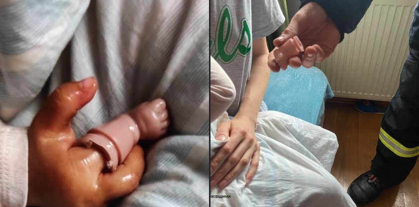 У Франківську палець немовляти застряг в іграшці, знадобилася допомога ДСНС (ФОТО)