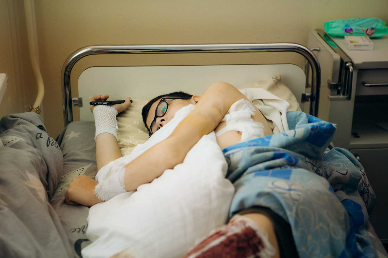Раніше ймовірно б ампутували: франківські лікарі рятують ногу 14-річному хлопцю (ФОТО)