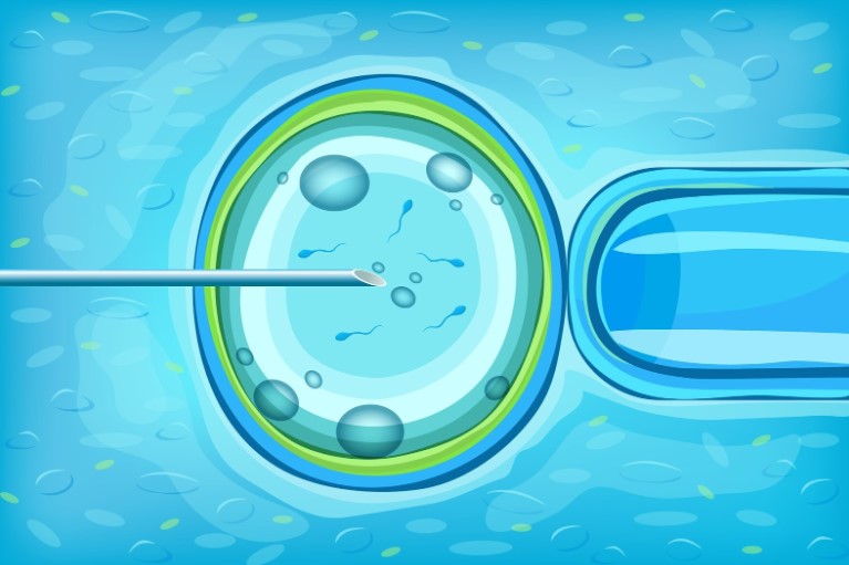 Екстракорпоральне запліднення: кому потрібна ця процедура?