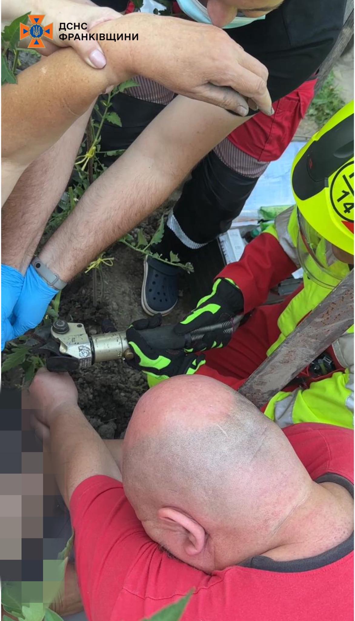 У Франківську рятувальники звільнили жінку від металевої арматури, що пробила їй руку (ФОТОФАКТ)