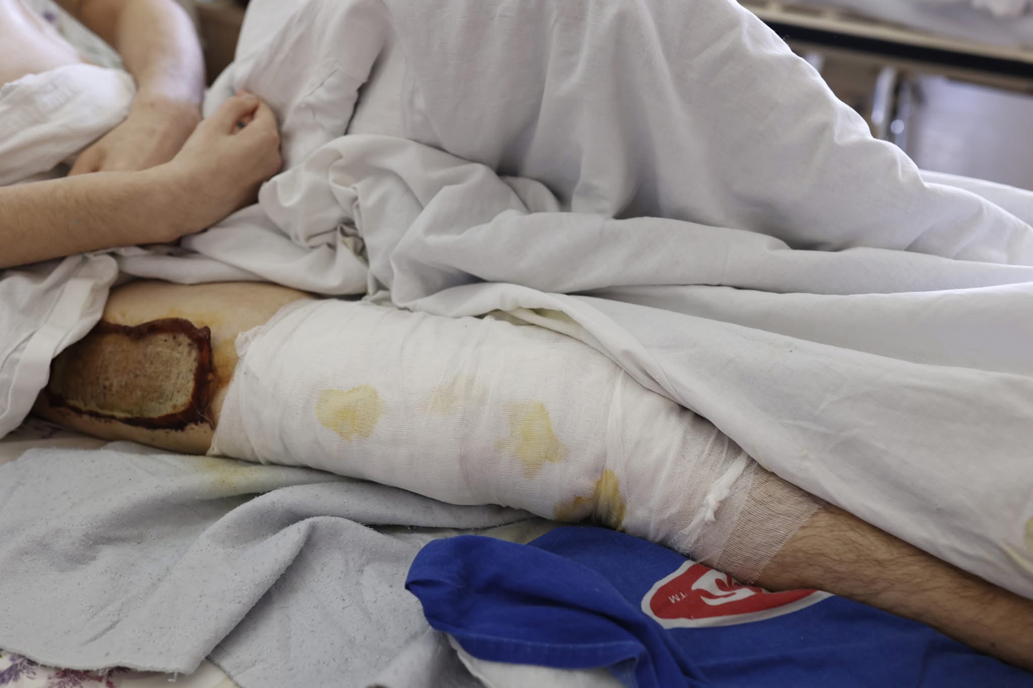 У Франківську латвійський хірург вп’яте оперує українських військових (ФОТО)