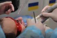 Стоматологічна клініка на колесах: як лікарі 50 полку НГУ лікують зуби військовим прямо на службі (ВІДЕО)